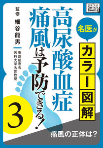名医がカラー図解! 高尿酸血症・痛風は予防できる! (3) 痛風の正体は? 電子書籍版