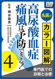 名医がカラー図解! 高尿酸血症・痛風は予防できる! (4) 専門医での診断と治療 電子書籍版