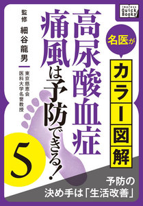 名医がカラー図解! 高尿酸血症・痛風は予防できる! (5) 予防の決め手は「生活改善」 電子書籍版